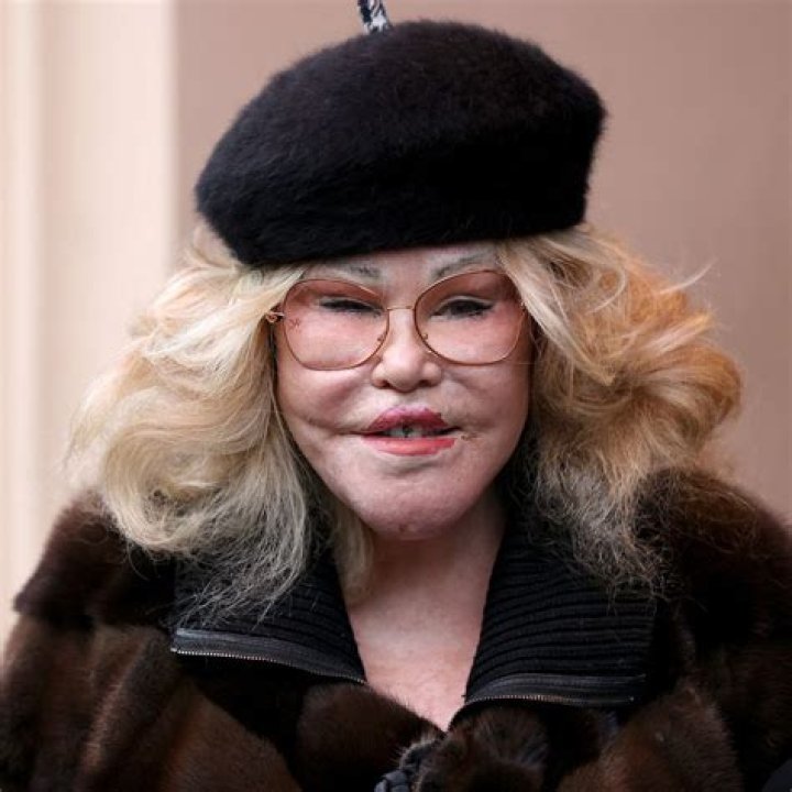 Unveiling The Enigmatic World Of "Catwoman Wildenstein": Discoveries And Insights